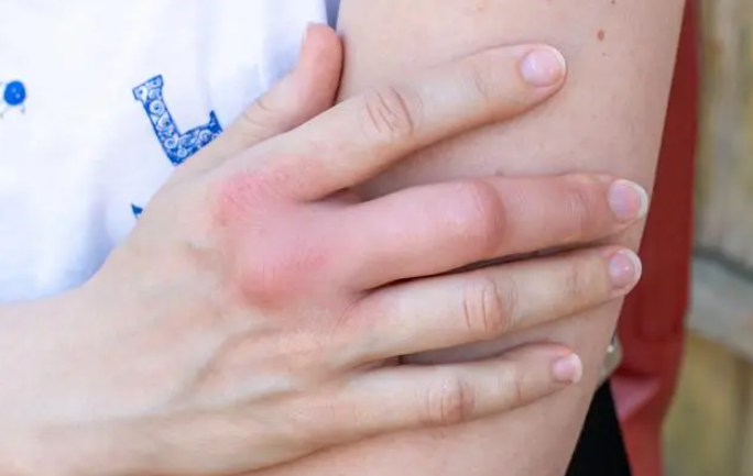 1703212830855383.png image.png