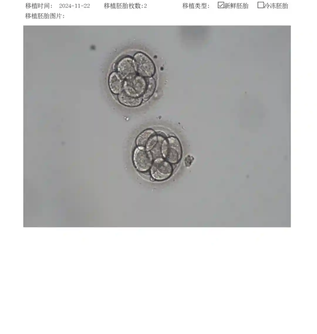 移植2枚8细胞1级鲜胚成功率高吗?