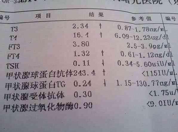 美国试管婴儿资讯：关于取卵前后的“宜”与“忌”