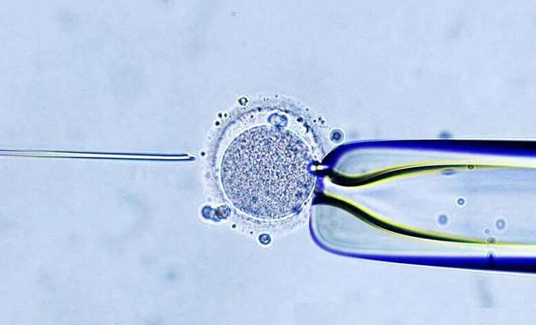 开封供卵试管 儿童奶粉开封后如何保存 ‘3个月彩超怎么看男孩女孩三个月的彩超’