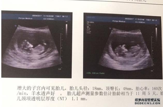 输卵管堵塞是怎么引起的？帮你找出了6大诱因，女性值得深思！-合肥什么医院做试管婴儿技术好