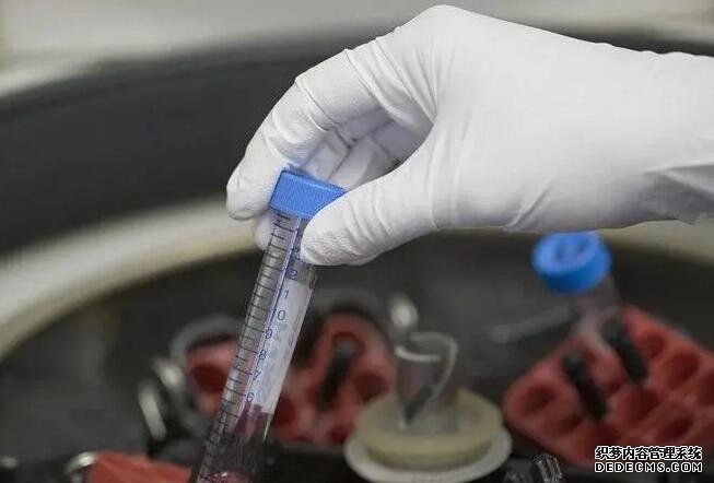 输精管道堵塞要做哪些检查,输精管堵塞的原因有哪些