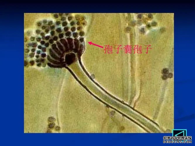 江苏省中医院试管婴儿怎么样 江苏省人民医院供精试管流程介绍: ‘四维胎盘位置判断男女’