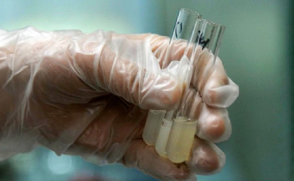 福州试管中心 福州哪家做试管婴儿成功率高?选择试管婴儿医院的标准是什么? ‘五个月的胎儿思维彩超男女辨别’