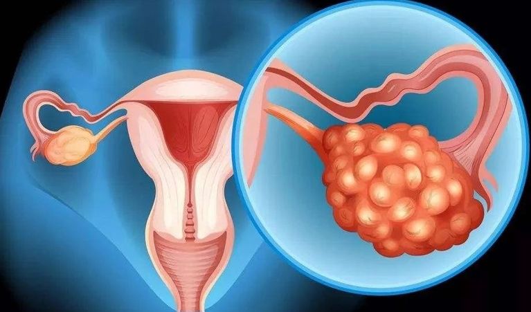 胚胎移植后怎么吃？北京试管婴儿医院哪家好？