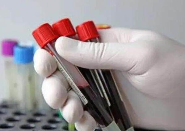 南宁借卵试管 2023南宁人工授精生男孩医院排名 ‘孕囊形状看男女什么时候最准’