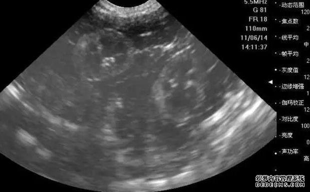 2022太原人工授精医院排名,附成功率及费用介绍-东南大学中大医院