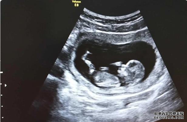 沈阳失独家庭补助政策 沈阳供卵试管费用多少,2022辽宁供(借)卵试管婴儿费用预估 ‘酒精测试尿液是男孩女孩准确吗’