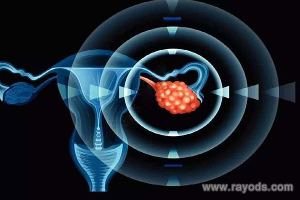 上海助孕试管婴儿医院排名,上海做第三代试管婴儿费用多少?