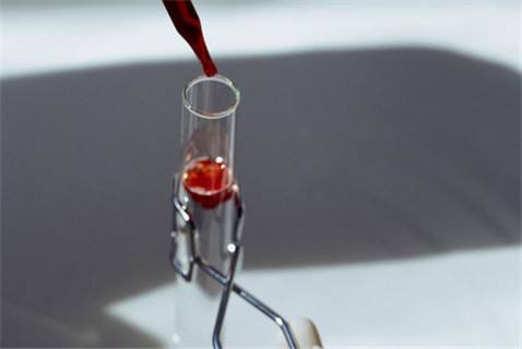 青岛市立医院能做试管婴儿吗 最新青岛哪家试管医院成功率最高 ‘孕囊大小22*11mm是男孩女孩’