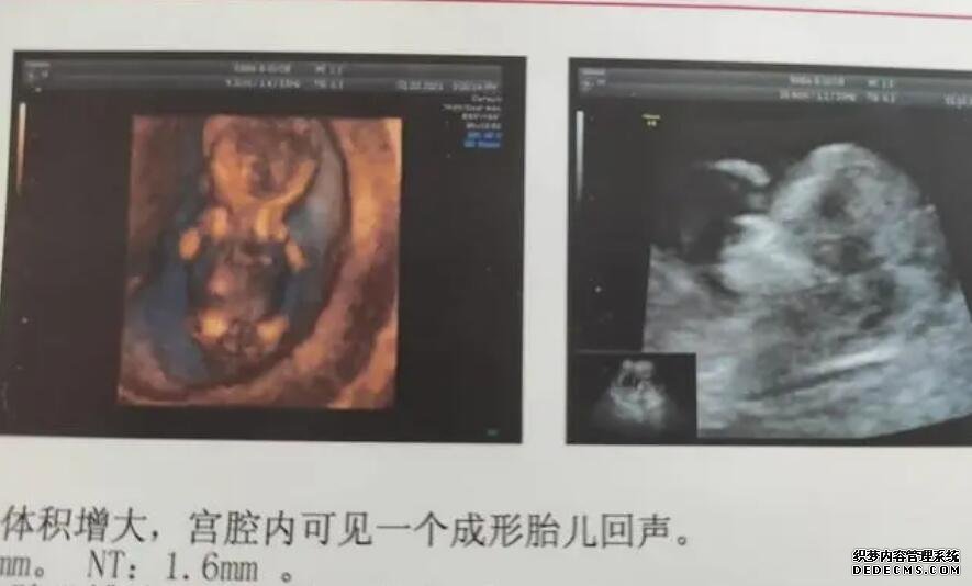 重庆可靠供卵资询 重庆新桥医院试管费用明细介绍： ‘18周b超看男女准确吗’