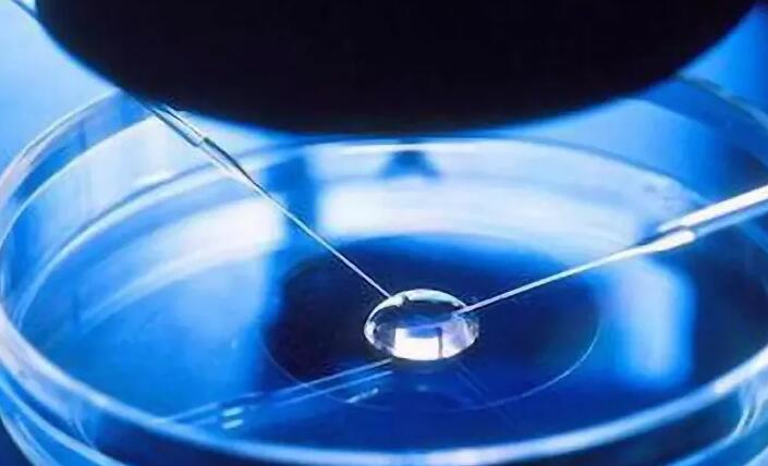 陕西试管排名 陕西试管婴儿报销生育险吗? ‘45天B超单孕囊3个数据如何看男女’