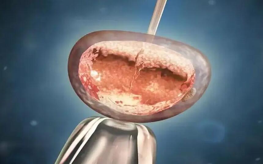 承德供卵试管 承德生殖健康试管婴儿如何?你一定要了解这些常识 ‘怀孕四个月四维女宝宝图’