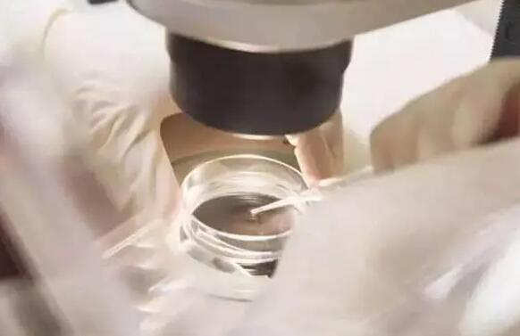 咸阳试管供卵 咸阳试管婴儿医院推荐 ‘男宝和女宝肚型’