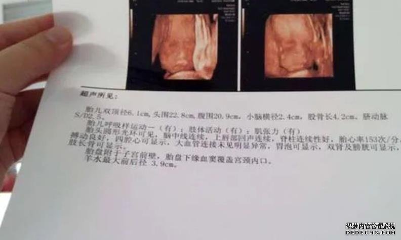 福州借卵代怀价格 最新福州哪家试管医院成功率最高 ‘b超如何测男女’