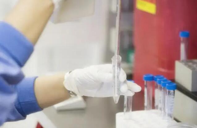 美国试管婴儿流程中怎么取精?取精几次合适?