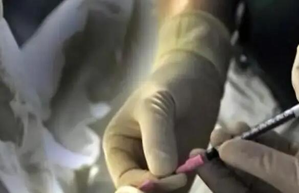 潍坊960试管医院 潍坊哪个医院做试管婴儿好?是否能一次成功? ‘四维胎儿趴着能看男女吗’