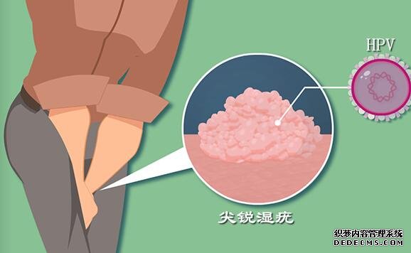 厦门那儿代生 2022年厦门大学附属第一医院试管婴儿费用 ‘胎儿双顶径头围偏小是女孩吗’