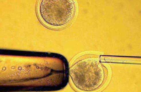 沧州试管供卵 2023
沧州试管婴儿医院排名,附试管婴儿成功率和费用一览 ‘双