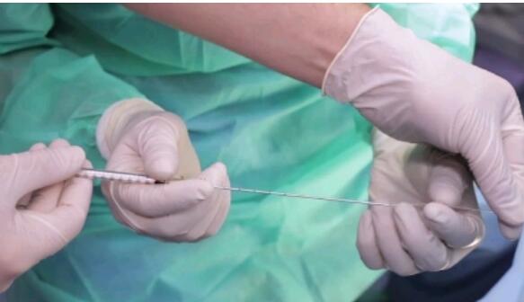 湖北试管医院哪家好 湖北能做供卵试管婴儿的医院有几家 ‘彩超下的男孩’