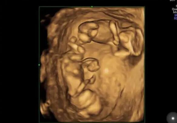 江苏试管供卵 江苏做试管包生男孩是真的吗? ‘孕妈妈总觉得自己怀的是男孩