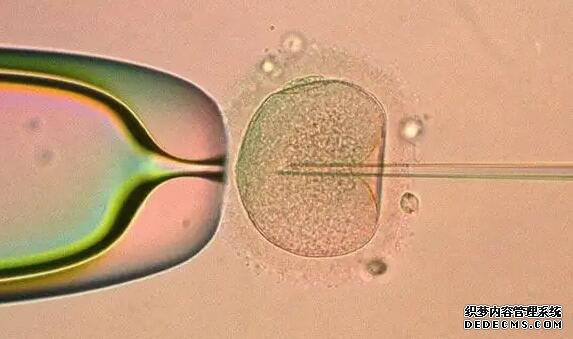 苏州试管代孕包性别 点苏州试管技术最好的医院,共2家均能同时开展一二三代 ‘孕囊是三个数据是男孩还是女孩’