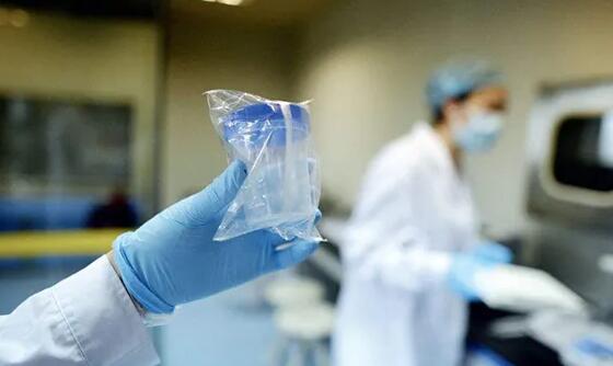 这个那个不能吃,到底试管婴儿移植后有哪些饮食禁忌?