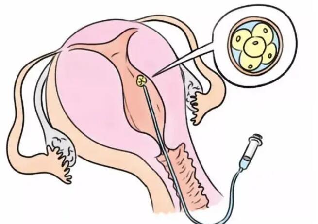 江西捐卵交流群 2022在南昌做第三代试管婴儿选择省一附院好还是江西妇保院好？附江西三代试管医院排名 ‘用双顶径怎么看男女’