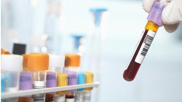 泰国试管婴儿医院流程，取卵和取精需要在同一天进行吗？