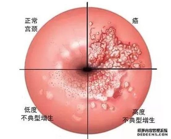 山西代孕qq 山西省生殖遗传医院试管咋样?试管费用要多少? ‘7个月酒精测男女结果’