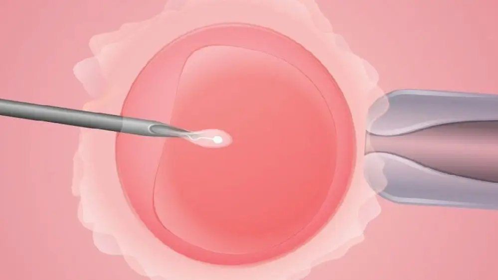 1718085693270542.jpg 13A996571.jpg