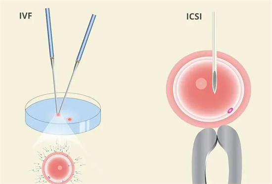 试管促排后为什么取卵数量还是很少？药物反应差是主要诱因