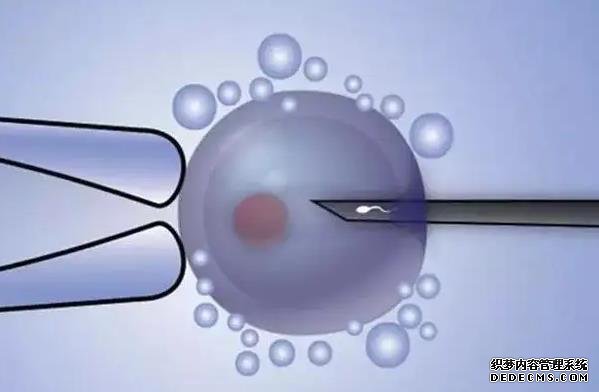 江苏代孕后怎么上户 江苏省做试管婴儿医院排名 ‘90天彩超女宝宝图片’