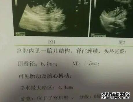 重庆妇幼保健院和湖南湘雅中信医院做试管哪个好 重庆妇幼供卵试管流程 ‘做b超如果是女孩的图片’