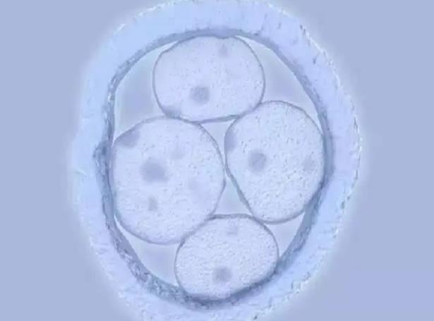 南阳能做试管吗 南阳哪家医院作试管婴儿好？怎样选择医院？ ‘孕10周b超可以看男女吗’