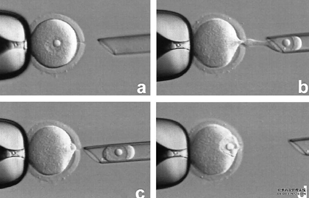 上海华山医院地址 上海哪家试管医院最好,上海试管医院排名介绍 ‘7周b超单子孕囊3.1*2.0*3.9是男孩女孩’