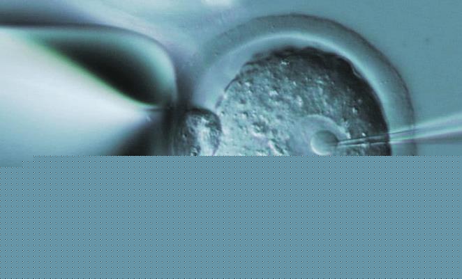 第三代试管 深圳 深圳中山泌尿试管费用是多少呢 ‘13周看b超单子怎么看男孩女孩’