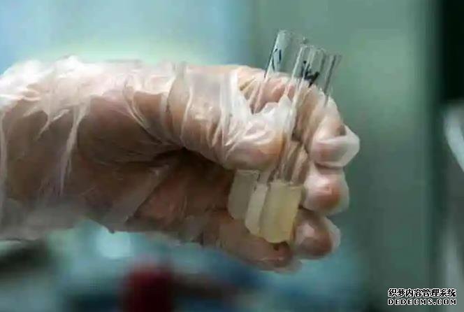 为什么要进行优生优育检查?是不是多此一举呢?