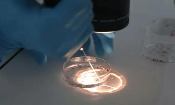 合肥试管婴成功 2023合肥试管婴儿的费用医保可以报销吗? ‘四维B超查出女孩,生的时候是儿子’