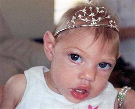 夏日孕妇饮食需注意：夏天吃什么水果？