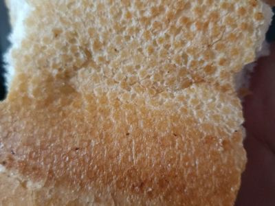 婴儿体癣的成因与预防探讨