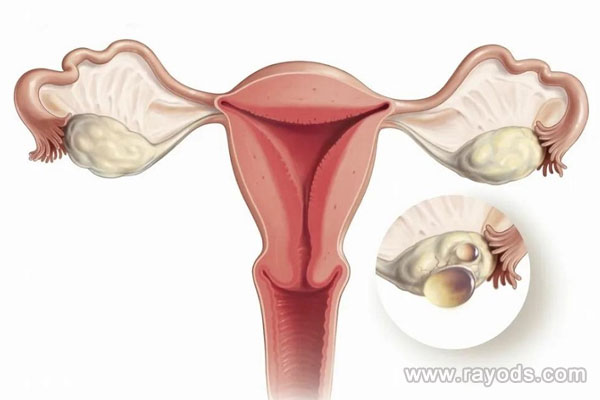 正常卵泡萎缩不会影响怀孕几率