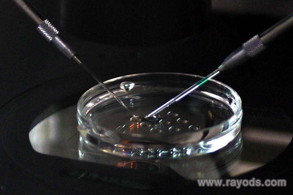 做试管婴儿前的准备