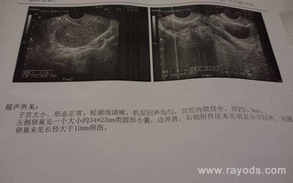 卵巢早衰 试管成功,南京助孕试管多少钱?