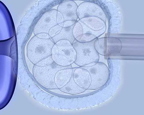 高龄做试管，这些经验能帮你