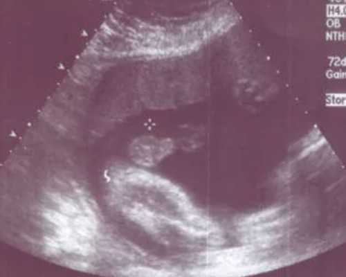 在江西做试管婴儿，这几家医院值得你考虑