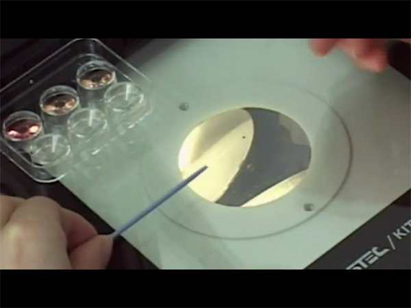 试管婴儿筛选男女哪个几率高？2025年做一次试管需要多少钱