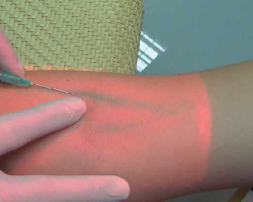 丽水人民医院做试管婴儿怎么样？医生水平如何？