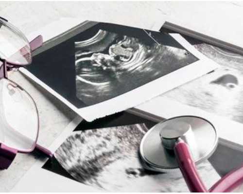 孕酮正常值是多少?孕酮偏低有哪些影响