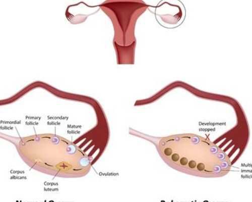 严重少精弱精做试管，成功率会怎样